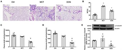 Donepezil Ameliorates Pulmonary Arterial Hypertension by Inhibiting M2-Macrophage Activation